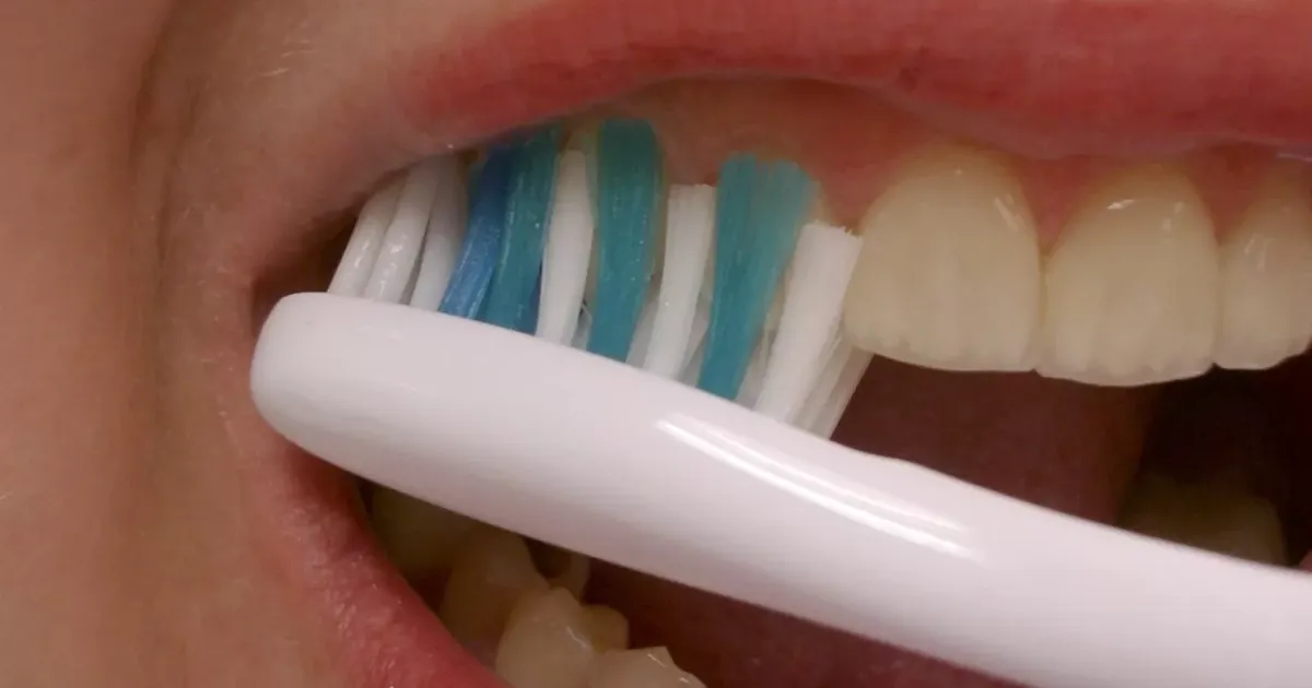 Cham Soc Rang Mieng Sau Khi Dinh Da De Giu Da Ben Dep