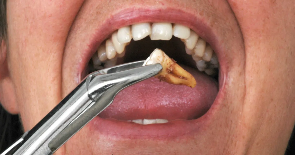 Loi ich cua viec nho rang