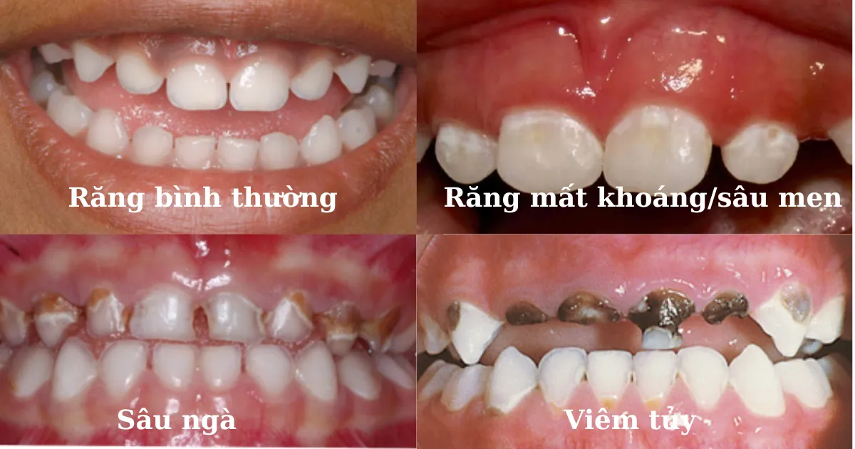 Rang binh thuong