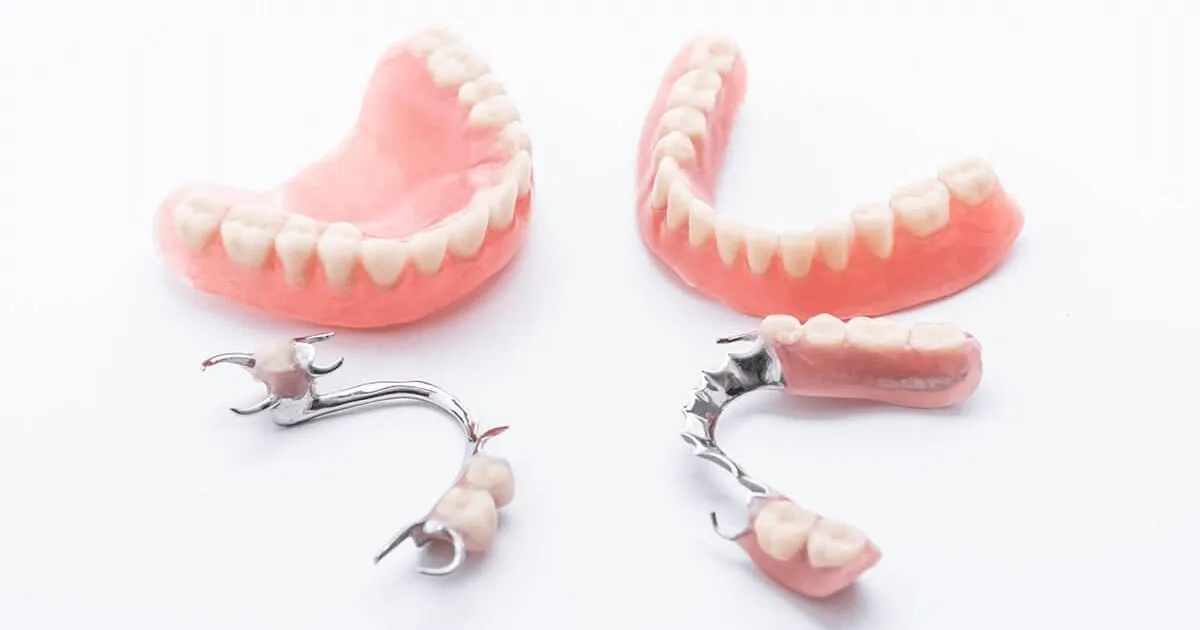 Rang gia thao lap Can Tho Nha khoa APEX min