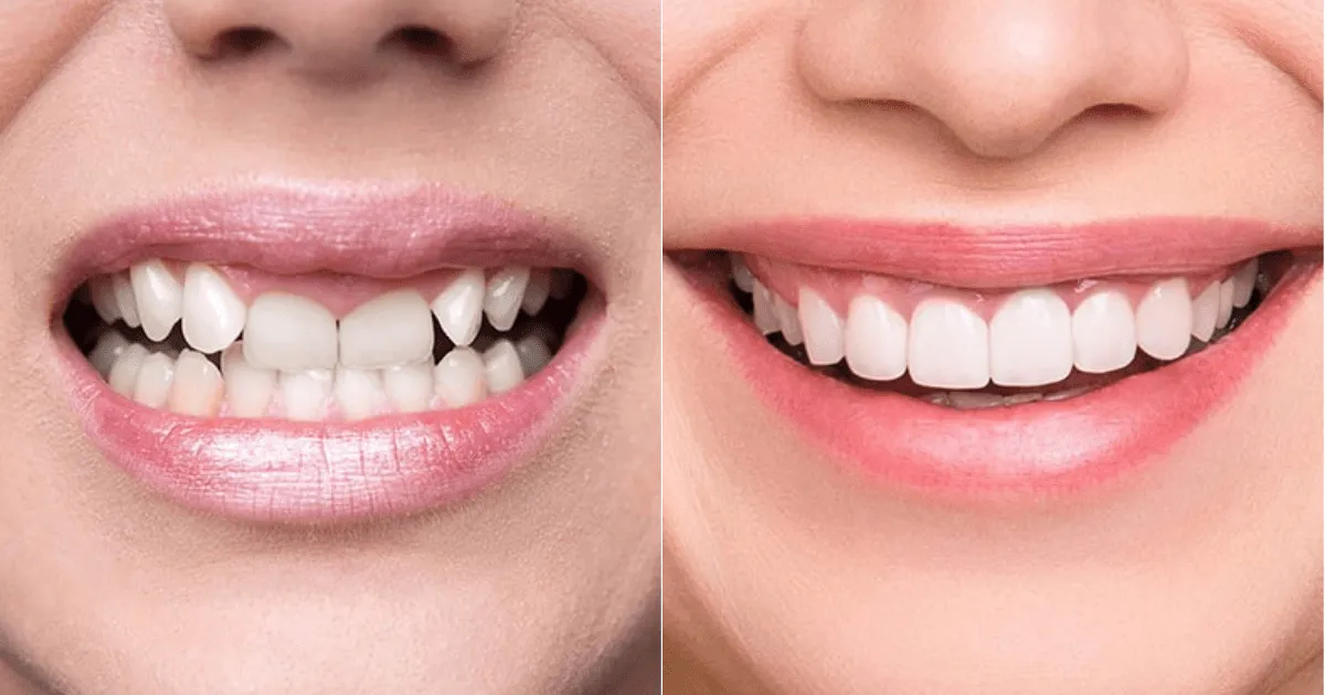 Tai Sao Viec Lua Chon Nha Khoa Uy Tin Lai Quan Trong