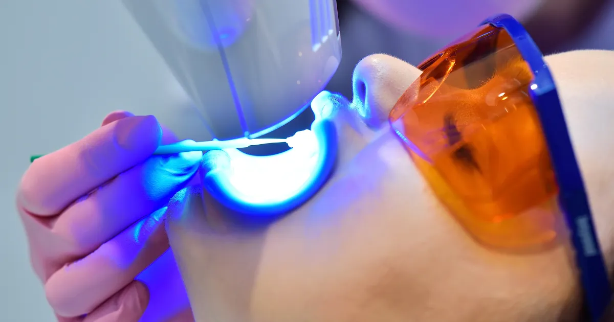 Tẩy trắng răng 2 Thiet ke chua co ten 10