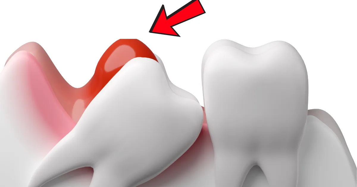 Thiet ke chua co ten 13