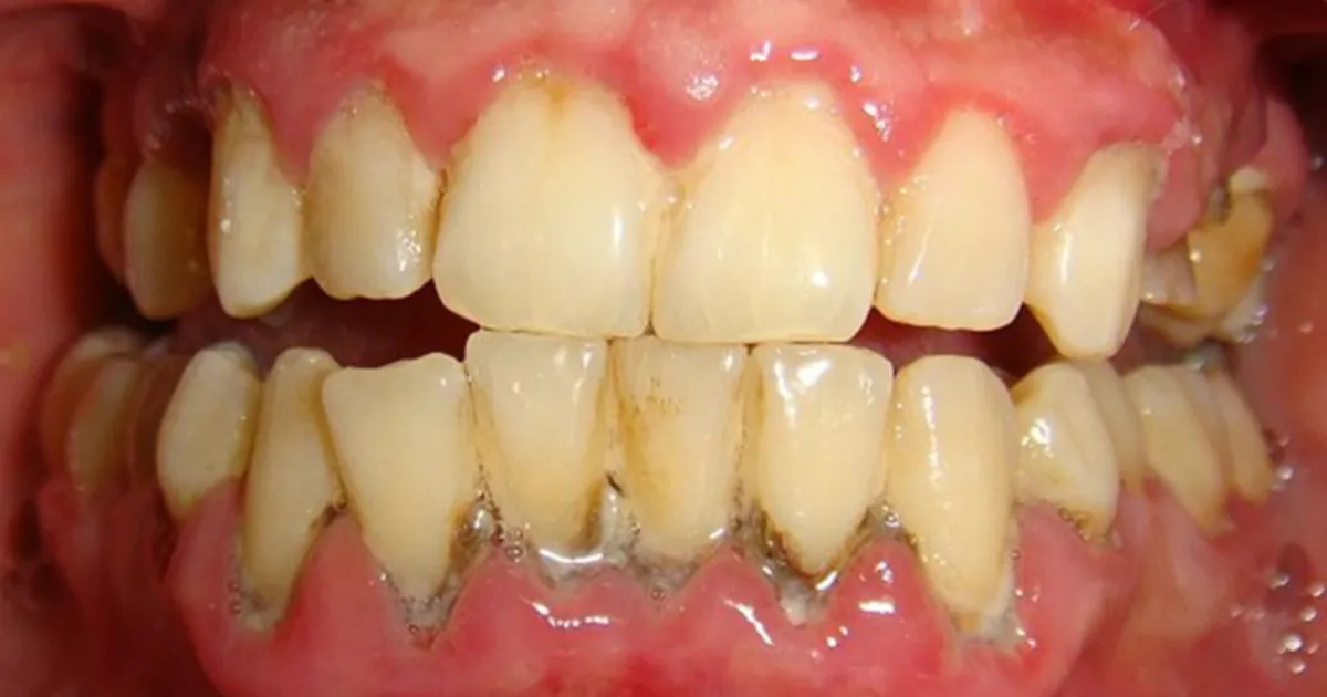 Thiet ke chua co ten 14