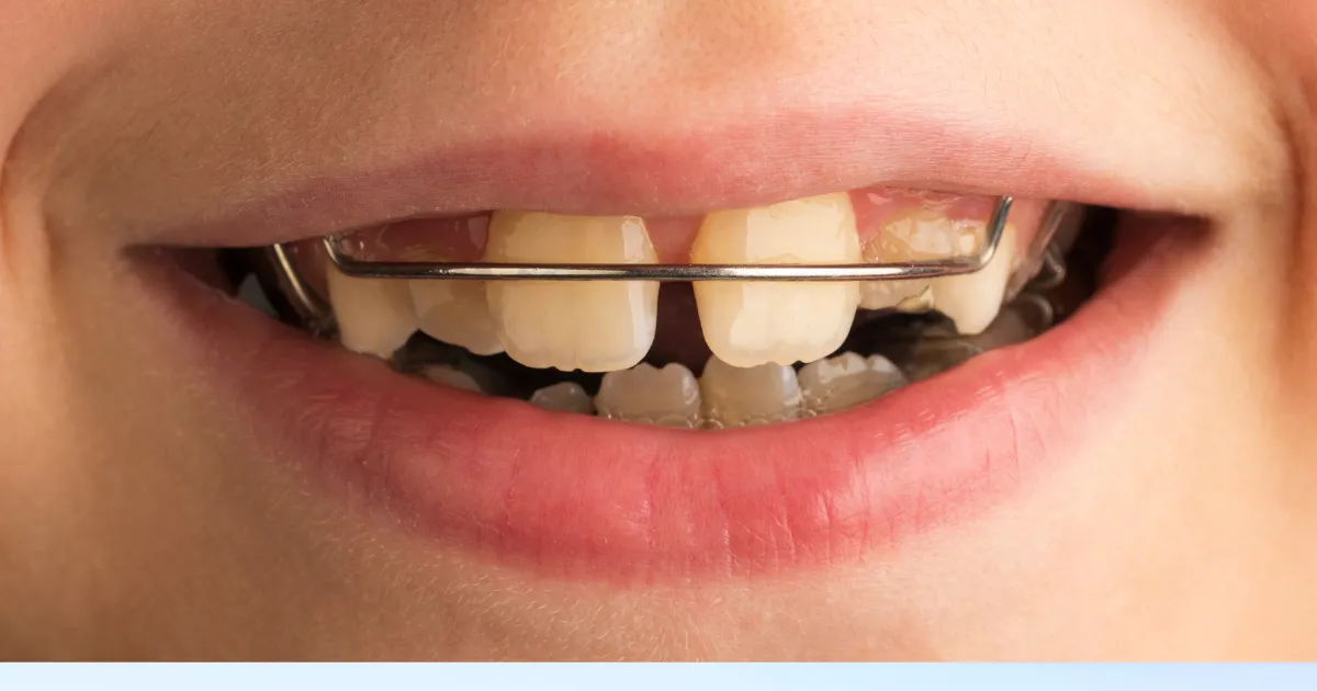 Thiet ke chua co ten 19