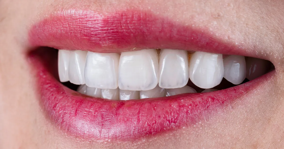 Thiet ke chua co ten 5