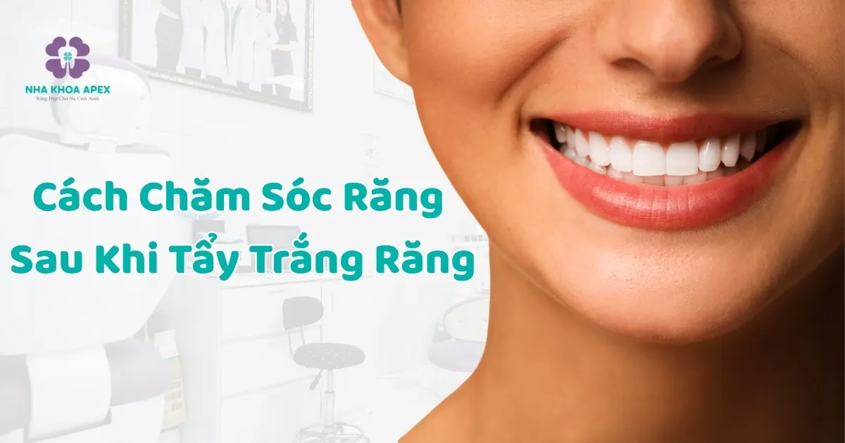 Tẩy trắng răng Cần Thơ
